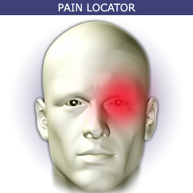 cluster headache pain locator