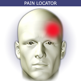 migraine pain locator